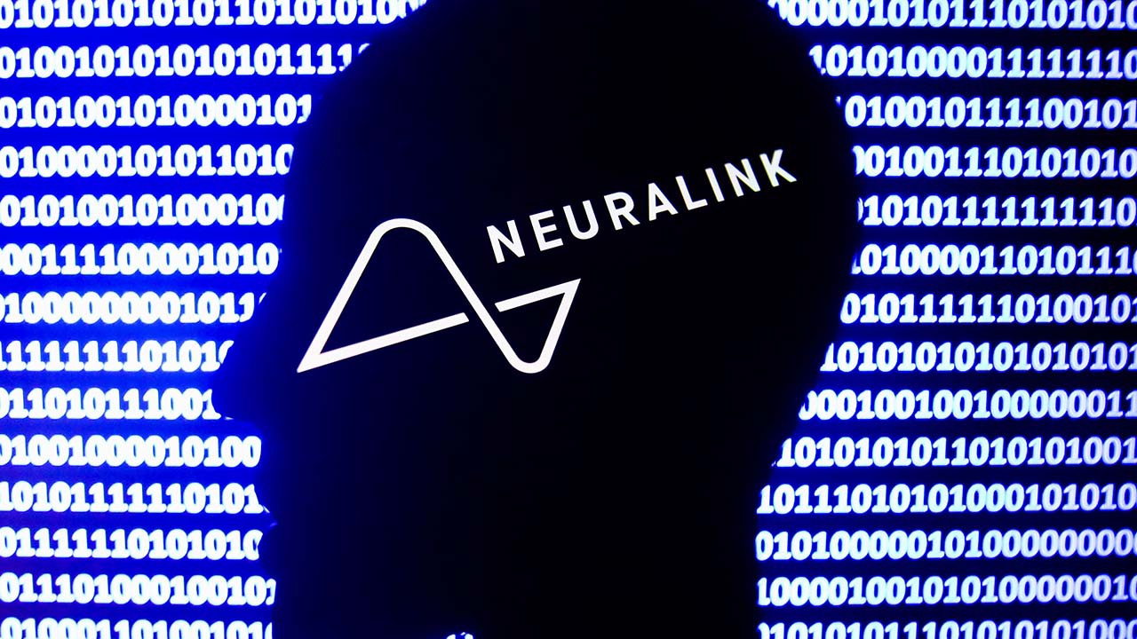 马斯克计划在自己大脑中植入脑机接口设备，Neuralink 将开始人体试验 - 互联网